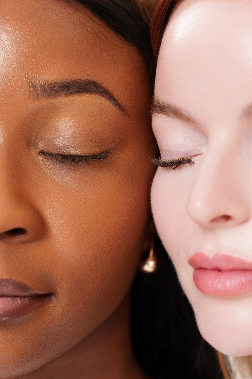 Care for skin of color at EmpaGlow Skin Clinic Calgary